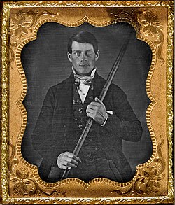 Portrait of Phineas Gage